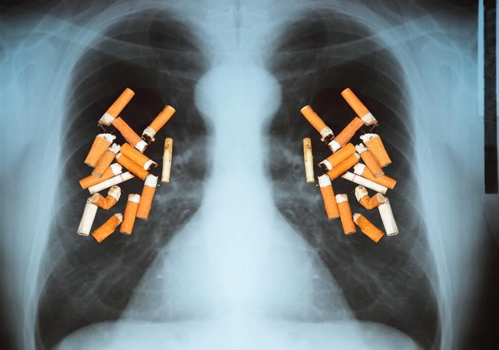 Hogyan befolyásolja a cigaretta a tüdőt